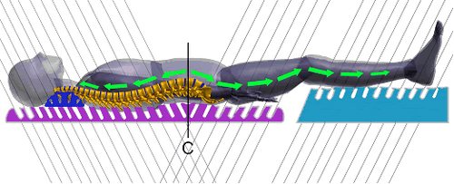 Aktiv-Dehnsystem T5 – Bild 3